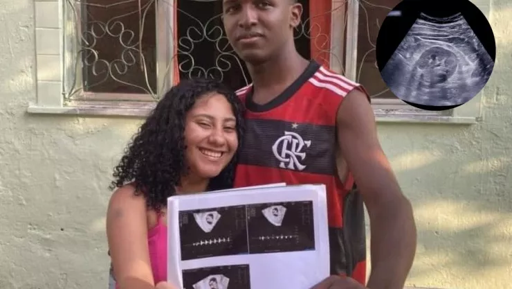 Embarazo de quintillizos.