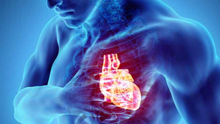 que es un colapso cardiovascular muerte papa Francisco