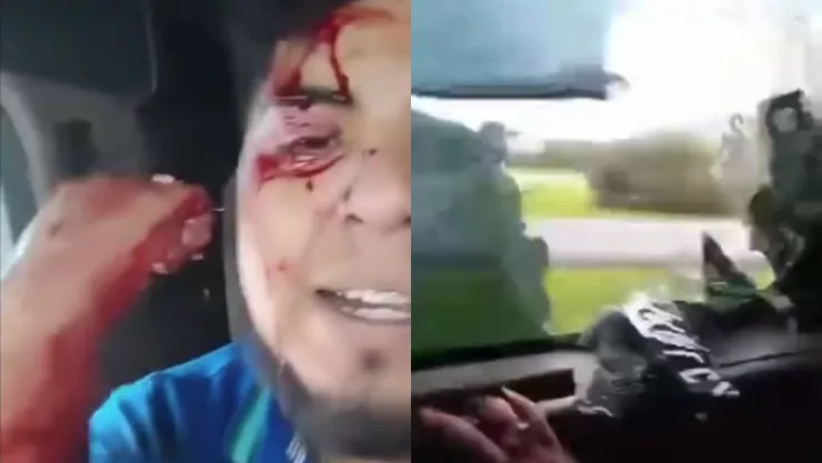 VIDEO: Chofer de tráiler es baleado en la México-Querétaro y se graba pidiendo ayuda