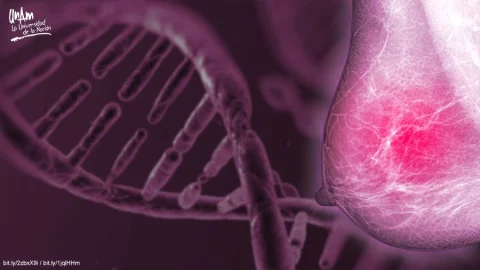 Predisposición hereditaria al cáncer de mama