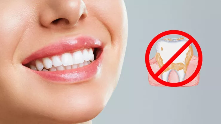 Remedio definitivo para quitar el sarro de tus dientes sin ir al dentista