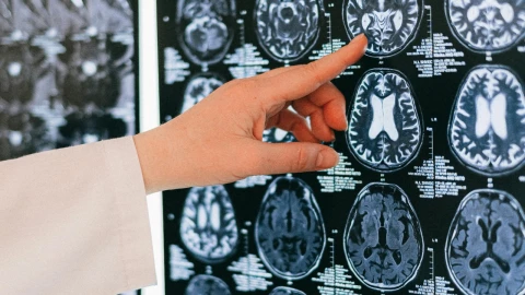 ¿Sabías que puedes ayudar a tu cerebro a que no se devore a sí mismo?