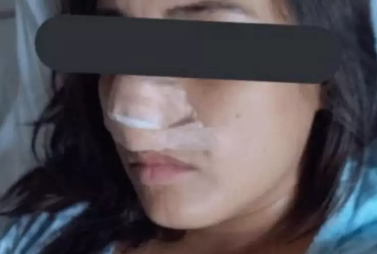 Jazmin nariz agresor prófugo