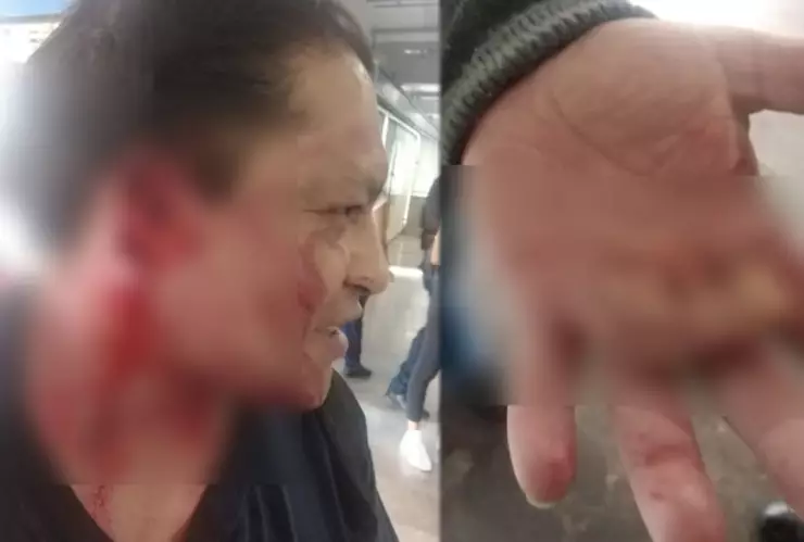 Arrancan oreja a sujeto en el metro.jpg