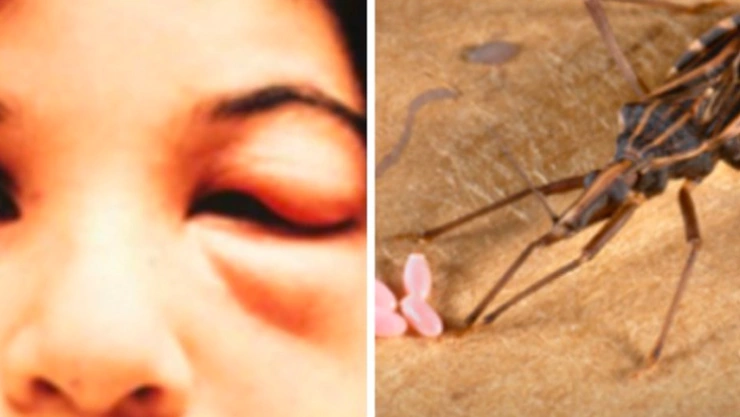 Con nanopatículas infectan al parásito que causa la enfermedad de chagas