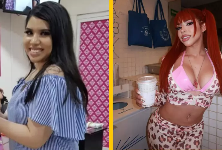 yeri mua antes y después de sus operaciones