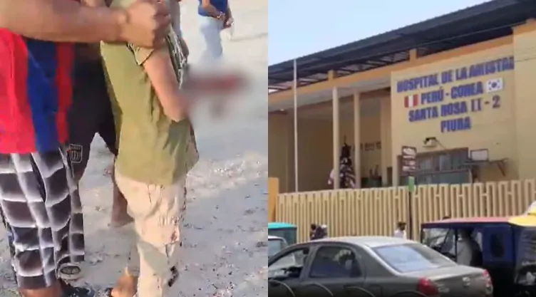 Niño pierde la mano izquierda después de jugar con pirotecnia en Piura, Perú