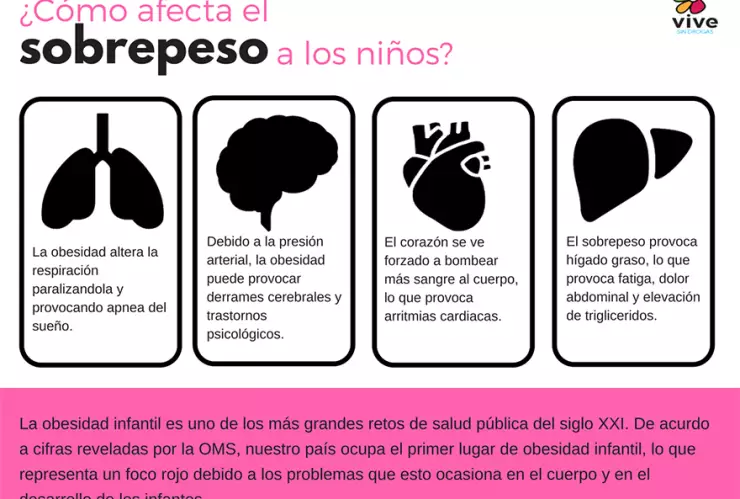 Infografia daños de obesidad infantil