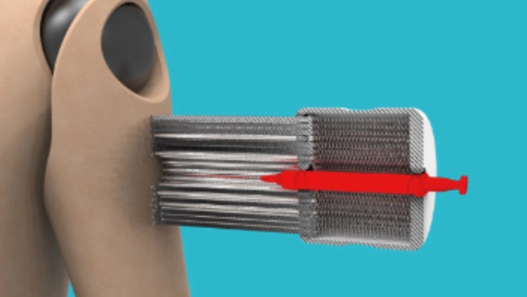 agujas Pinsoft dispositivo