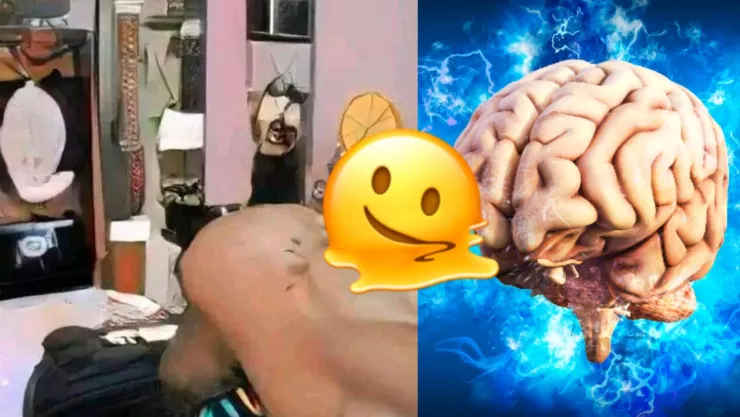 Derrame cerebral imagen