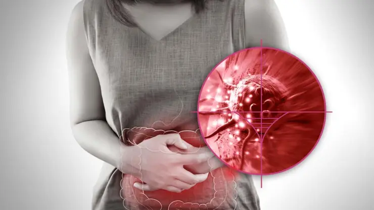 Estudian derivados del árnica para tratar el cáncer de colon