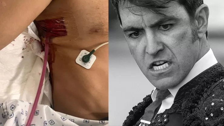 Arturo Macías, el torero sufre cornada, le perforó el pulmón