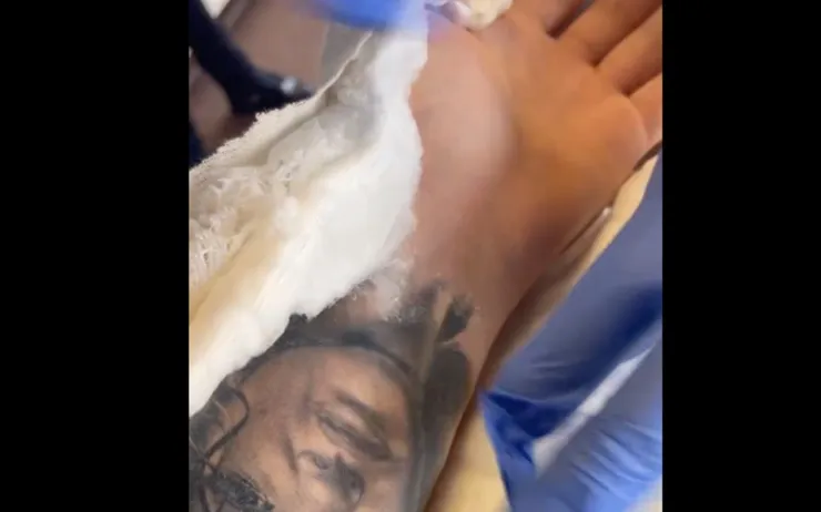 Canelo Álvarez operacion mano izquierda