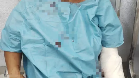 mujer apuñalada en uman