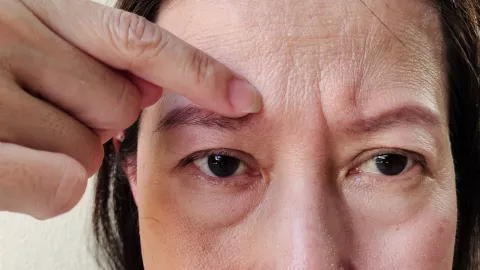 S&eacute;rum casero con col&aacute;geno para eliminar las arrugas a los 50 a&ntilde;os