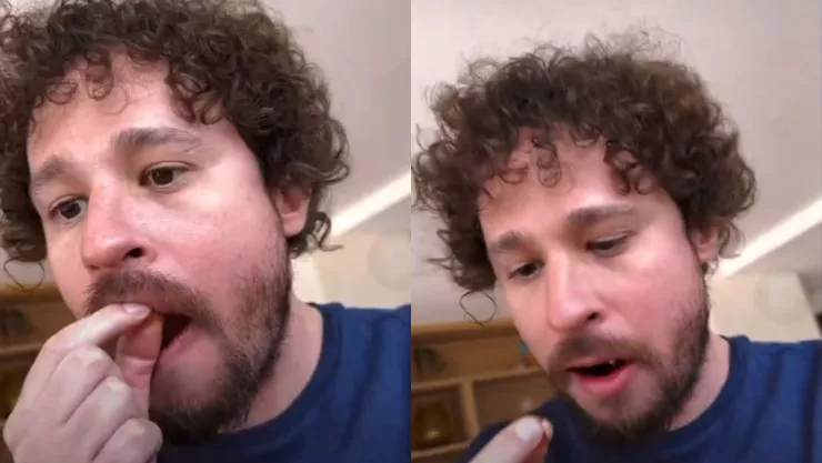 Luisito Comunica se quita los dientes