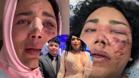 “Pensé que todo era un sueño”_ Paola Suárez reaparece tras sufrir agresión de su novio.jpg