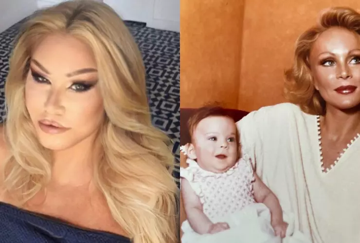 ¿De qué murió la “mujer gato” Jocelyn Wildenstein?