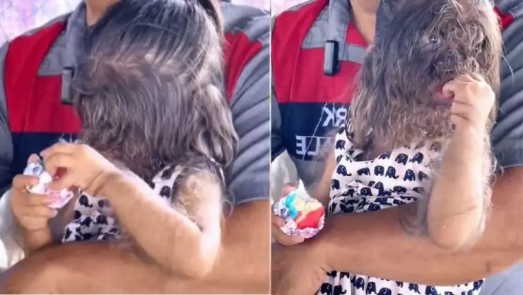 Niña con cabello en el rostro causa revuelo en TikTok; ¿cuál es su condición?