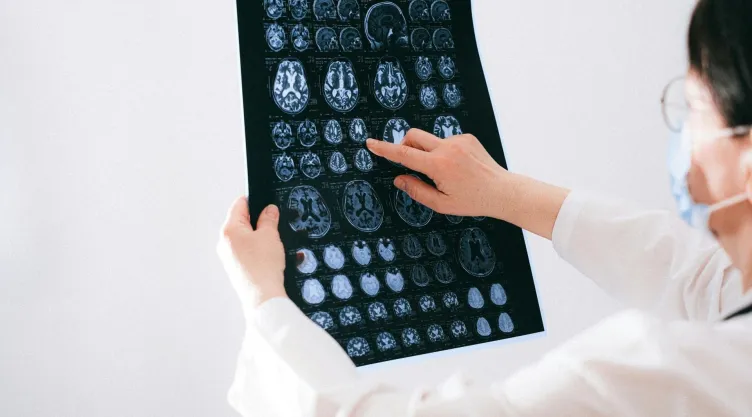 ¿Qué debo comer para tener un cerebro sano y fuerte?