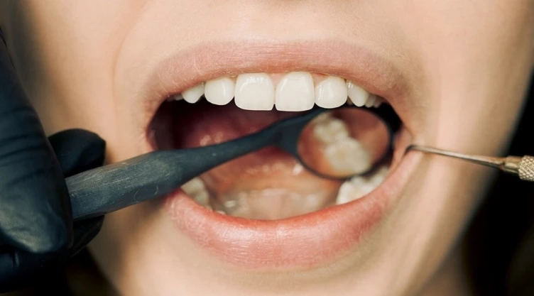 Fumar-por-qué-deja-dientes-amarillos-tabaco
