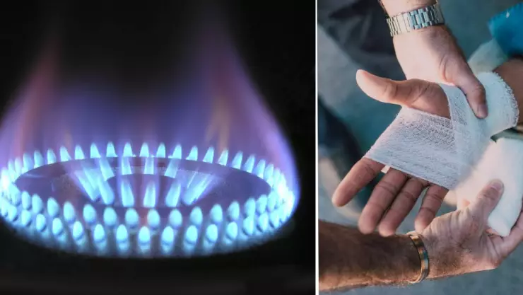 Mujer le quema las manos a su hijo en una estufa