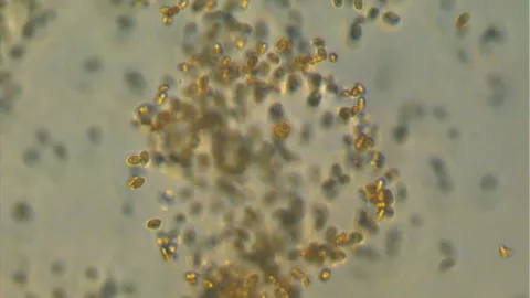 microbio marino carbono