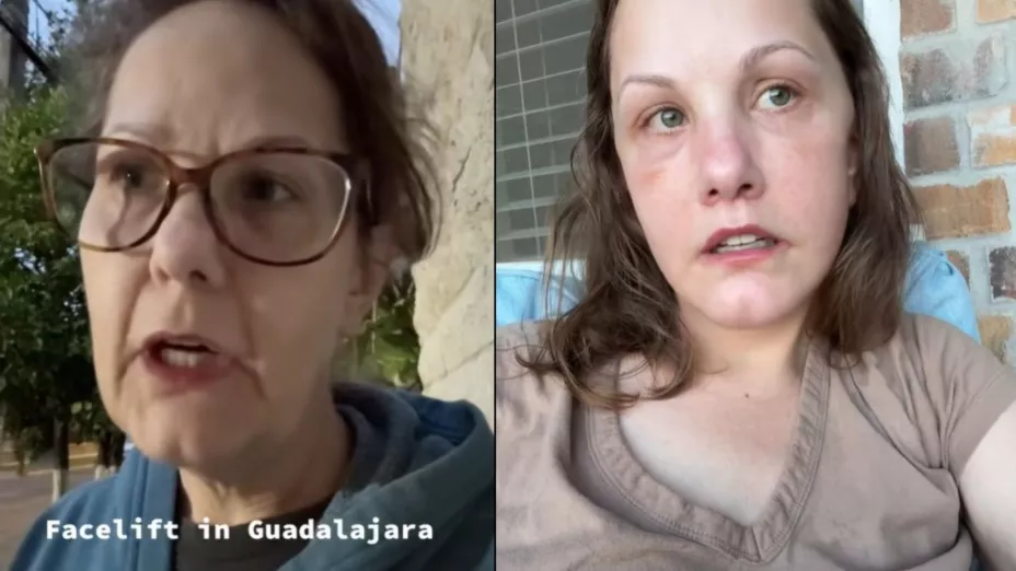 Encontró la fuente de la juventud Mujer documenta tratamiento rejuvenecedor que se practicó en Guadalajara