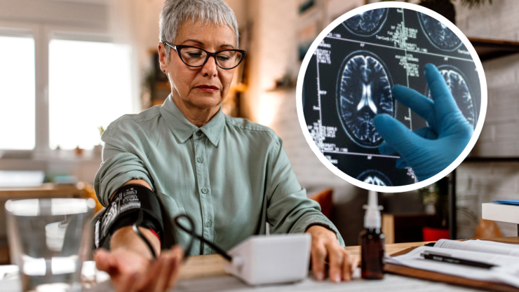 El vínculo entre la hipertensión y la demencia, según un estudio