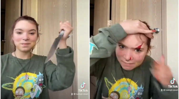 Joven se corta la cara por cumplir un reto