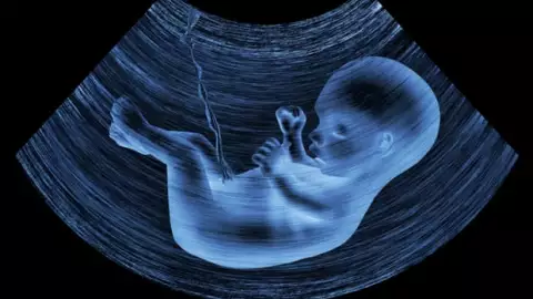 La presencia de microplásticos en la placenta humana se ha demostrado por primera vez