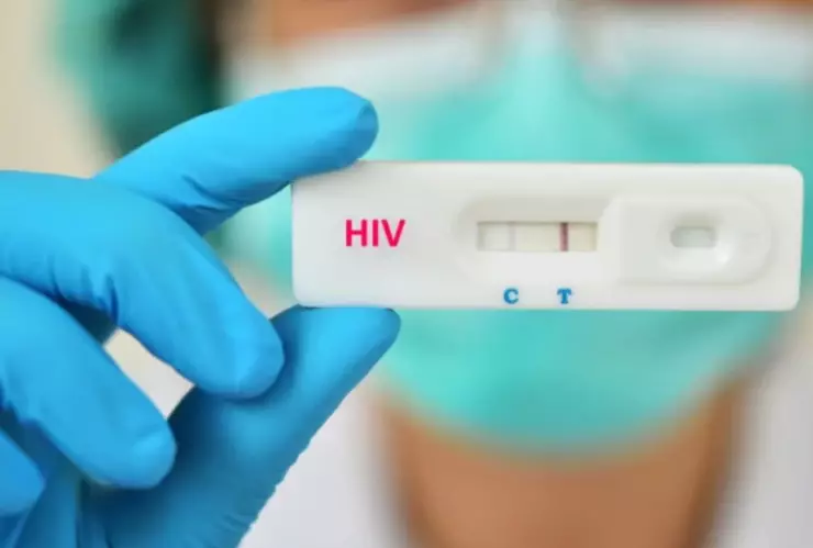 Síntomas del VIH Sida