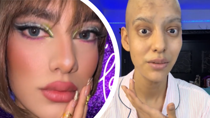 Tiktoker deja qumioterapia. 