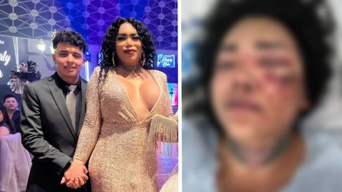 Novio de Paolita Suárez la golpea brutalmente
