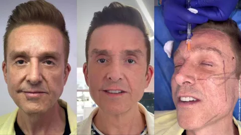 ¿Qué se hizo nuestro querido Daniel Bisogno en el rostro?