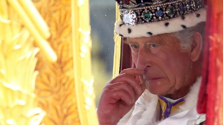 rey-Carlos-iii-manos-hinchadas-dedos-salchicha-edema