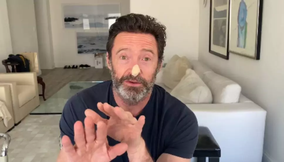 Hugh Jackman hablando sobre el carcinoma basocelular