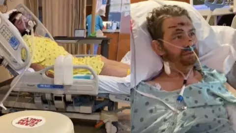 Hombre casi muere por un pelo encarnado en la ingle; quedó en coma.jpg