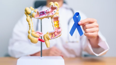 Cáncer de colon tiene nuevo tratamiento
