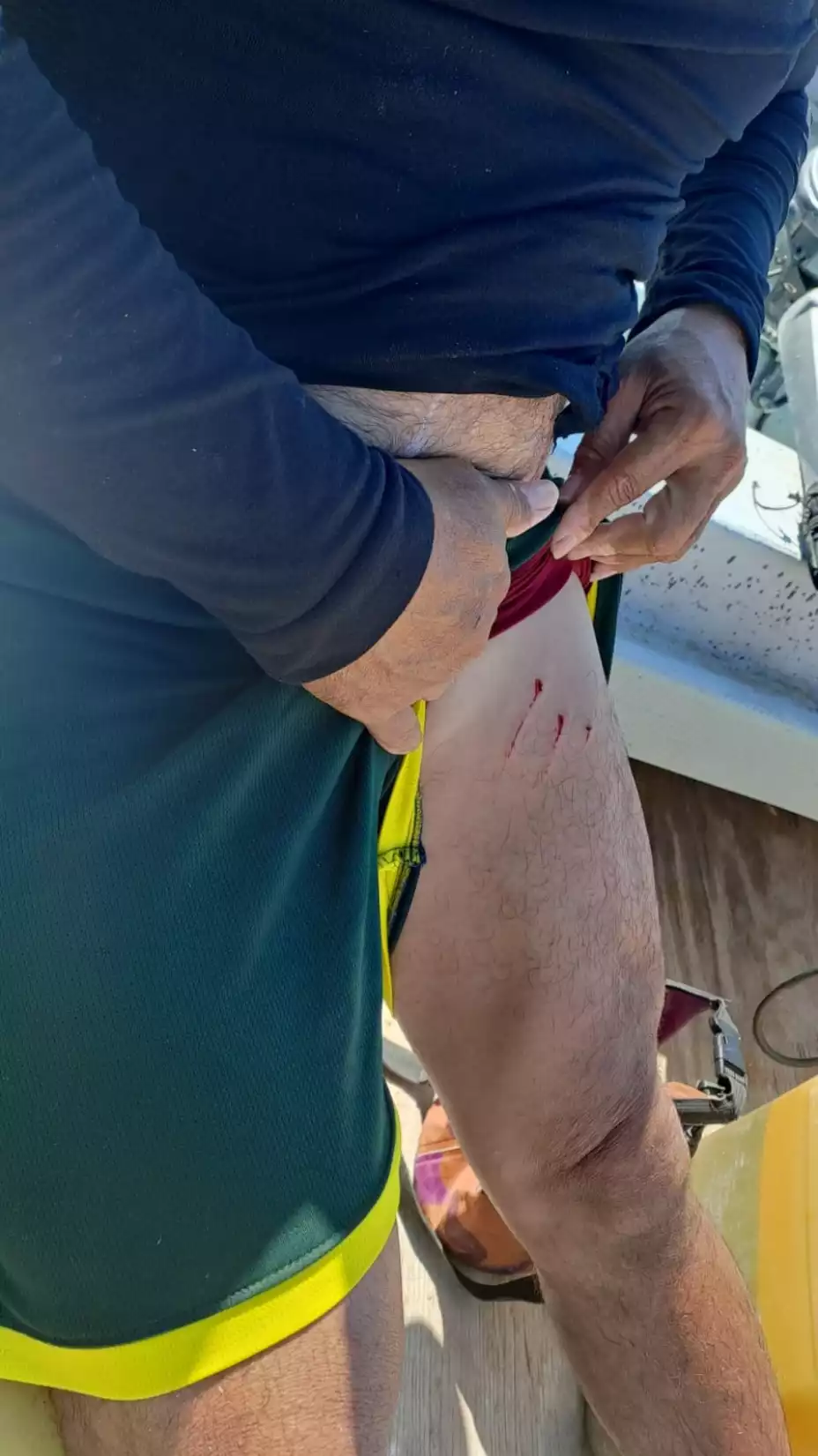 ATAQUE de lagarto contra pescador en Dzilam de bravo (FOTO)