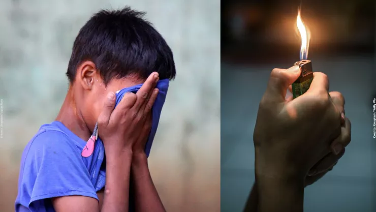 Estudiante de Querétaro fue quemado y discriminado por ser otomí.