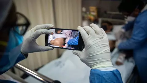 Paciente da positivo a viruela del mono, Covid y VIH en 15 días