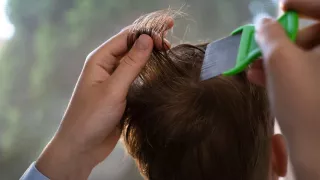 Video muestra a una madre retirando piojos del cabello de su hijo en transporte público de Puebla