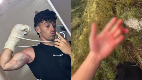VIDEO | ¡Imágenes sensibles! Influencer pierde dos dedos tras caer de un acantilado