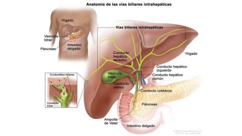 Sydney Towle colangiocarcinoma