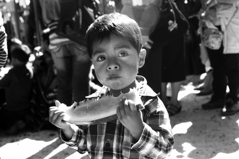 Malnutrición Fao