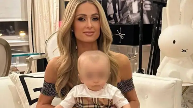 ¿Qué enfermedad tiene en la cabeza el hijo de Paris Hilton?