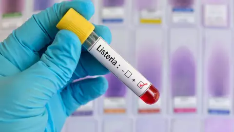 Nueve muertos y más de 50 contagios por brote de listeria