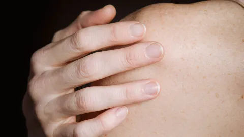 Los síntomas que indican que tu piel está deshidratada