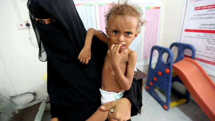 yemen niños mueren de hambre